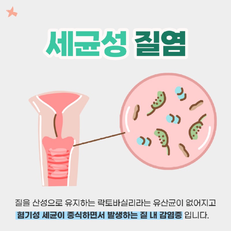 질 가려움증과 질통을 치료하는 올바른 방법을 알아보세요.