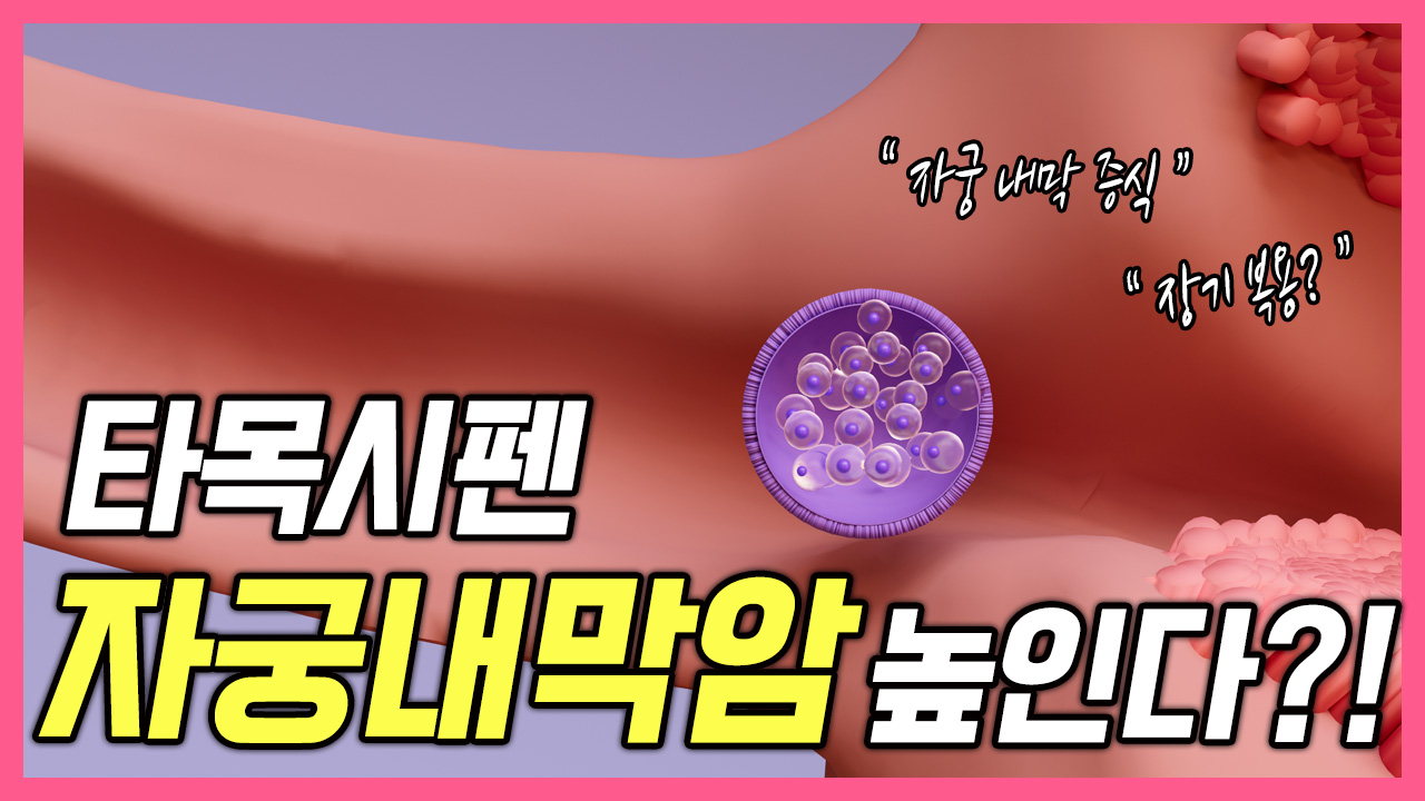 타목시펜을 먹으면 자궁내막암을 높인다고?  