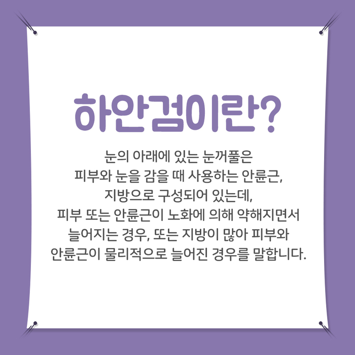 [성형외과] 하안검 2.jpg