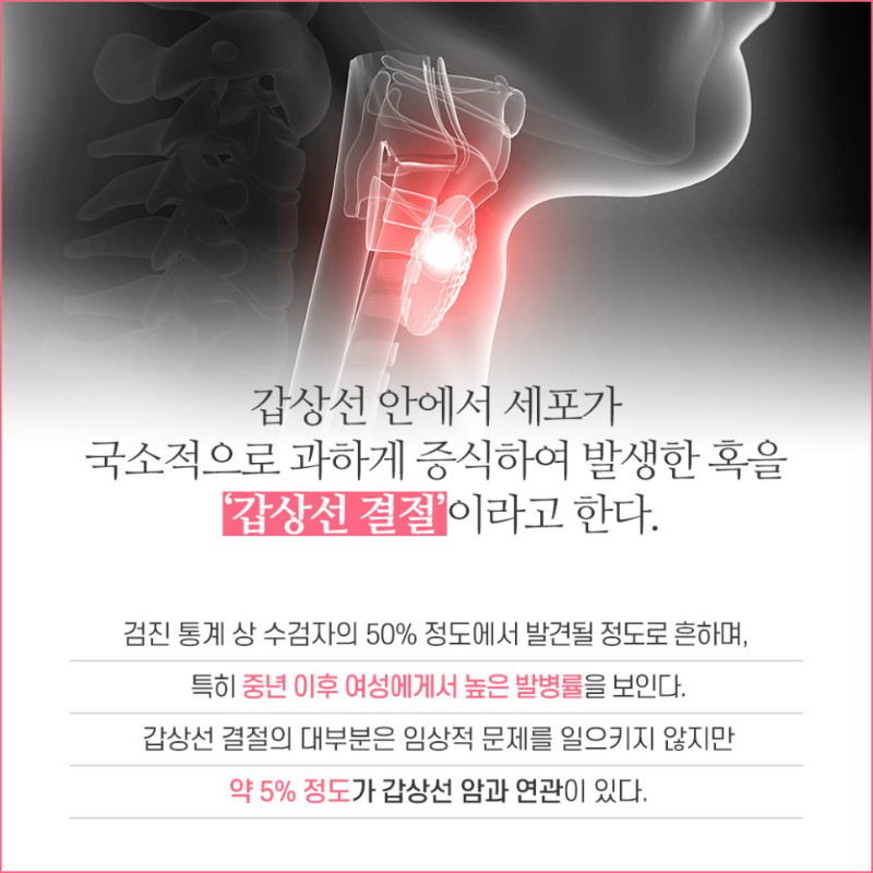 [갑상선센터] 갑상선 결절 3.jpg