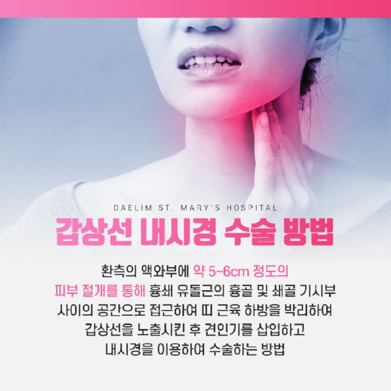 230125_갑상선내시경_04.jpg