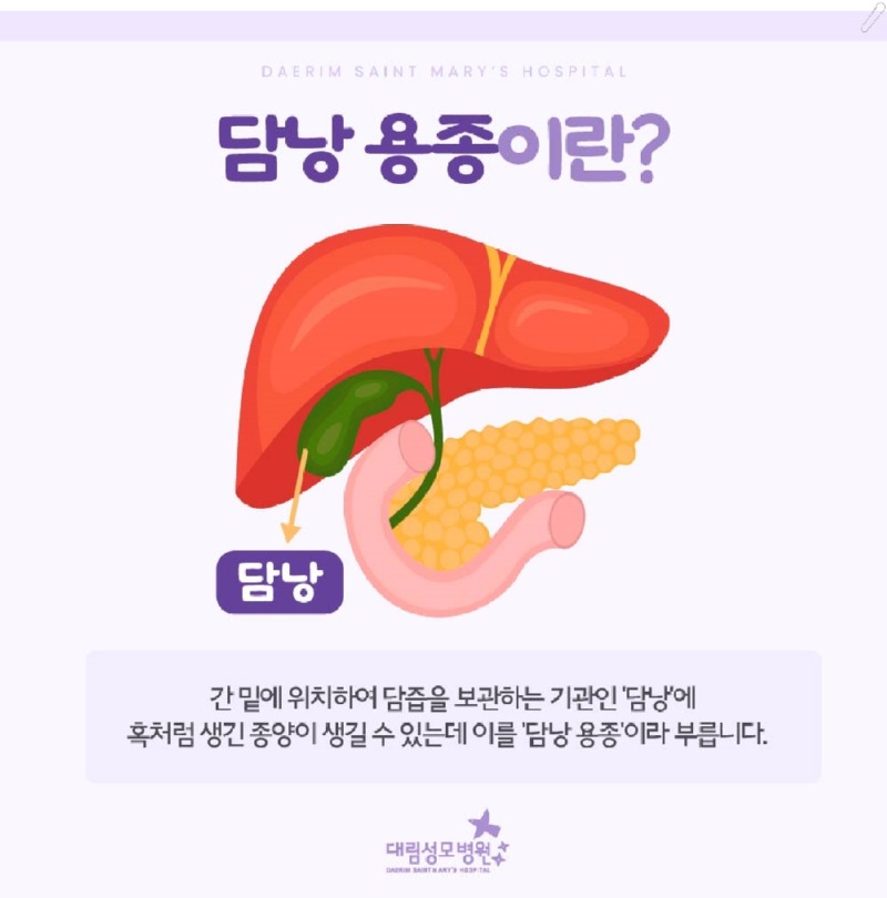 240924_대림성모병원_바이럴_담낭용종수술_(2).jpg