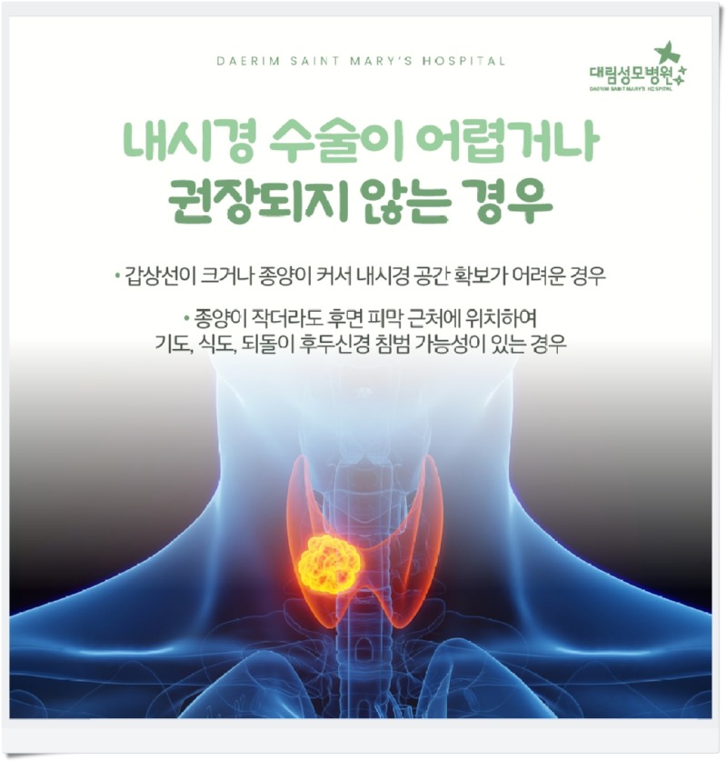 250721_대림성모병원_바이럴_갑상선암위치_(8).jpg